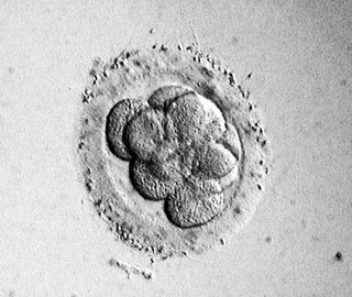ステッド ハッチング アシ 体外受精や顕微授精でしか妊娠できない方で予定人数出産したけど凍結胚が残ってる方凍結胚は何…
