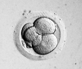 凍結胚移植 出産予定日