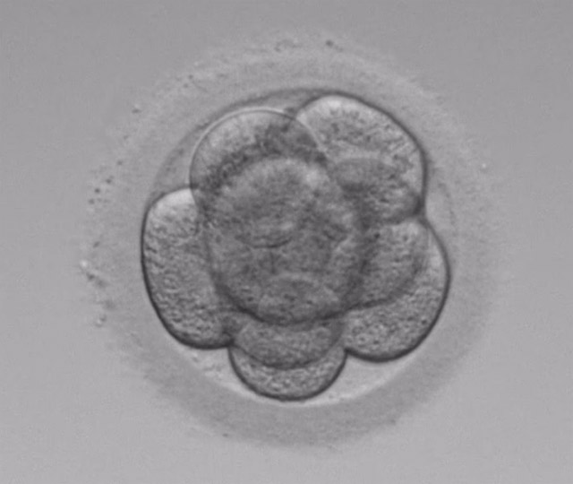 8分割（採卵3日後）